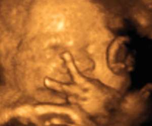 ultrasound of human fetus 31 weeks and 2 days