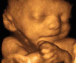 ultrasound of human fetus 32 weeks and 2 days