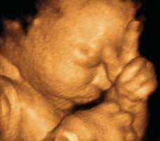 ultrasound of human fetus at 33 weeks and 2 days
