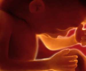 ultrasound of human fetus at 34 weeks and 2 days