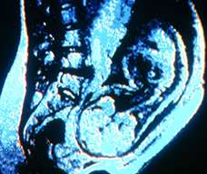 ultrasound of human fetus at 34 weeks and 5 days