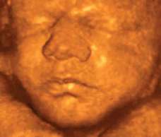 ultrasound of human fetus at 35 weeks and 1 day