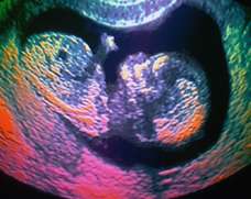 ultrasound of human fetus 35 weeks and 3 days