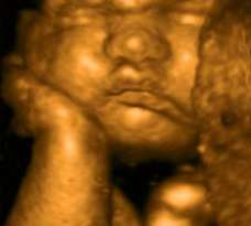 ultrasound of human fetus 36 weeks and 3 days
