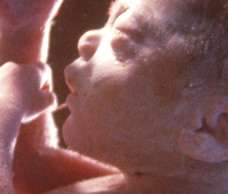ultrasound of human fetus 37 weeks and 1 day
