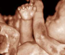 ultrasound of human fetus 37 weeks and 4 days