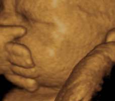 ultrasound of human fetus 38 weeks exactly