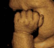 ultrasound of human fetus 38 weeks and 1 day