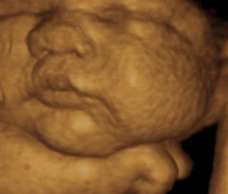 ultrasound of human fetus 38 weeks and 3 days