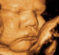ultrasound of human fetus 39 weeks and 1 day