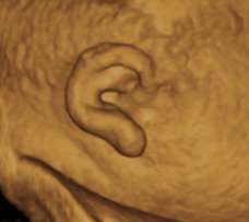 ear of human fetus 39 weeks and 2 days