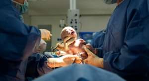 Risks and Types of C-Sections