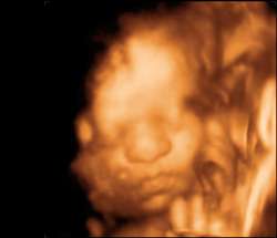 Fetus 25 Weeks 6 Days
