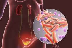Urinary Tract Infection
