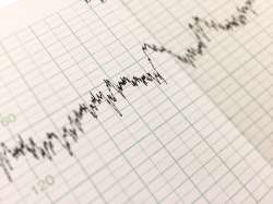 Should You Have Electronic Fetal Monitoring?