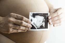 ultrasound of human fetus 36 weeks and 2 days