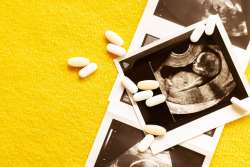 Clomid (Clomiphene) Fertility Treatment Side Effects