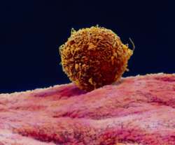 blastocyst resting on the lining of the uterus
