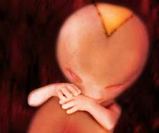 skull of human fetus at 11 weeks and 6 days