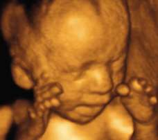 ultrasound of human fetus as 27 weeks and 1 day