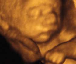 ultrasound of human fetus as 28 weeks and 4 days