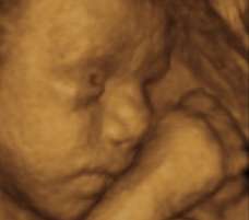ultrasound of human fetus 29 weeks and 1 day