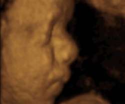 ultrasound of human fetus 29 weeks and 2 days
