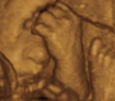 ultrasound of human fetus 29 weeks and 4 days