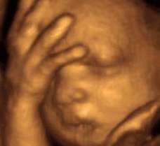 ultrasound of human fetus 30 weeks exactly