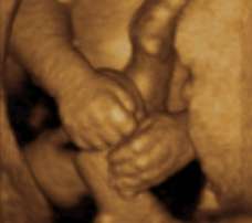 ultrasound of human fetus 30 weeks and 5 days