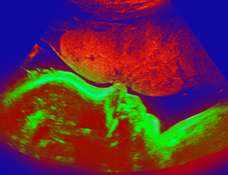 ultrasound of human fetus at 34 weeks and 6 days
