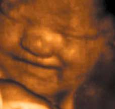 ultrasound of human fetus 36 weeks and 1 day