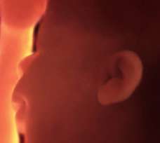 ultrasound of human fetus 36 weeks and 4 days