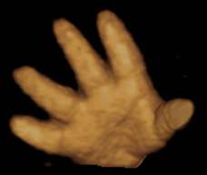 hand of human fetus 37 weeks and 2 days