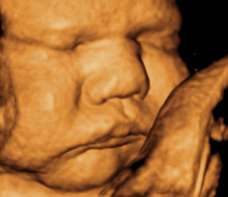 ultrasound of human fetus 37 weeks and 6 days
