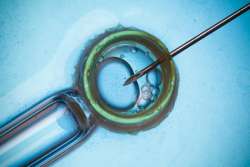Fertility Treatments