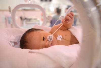 Baby Boy With Down Syndrome in NICU 