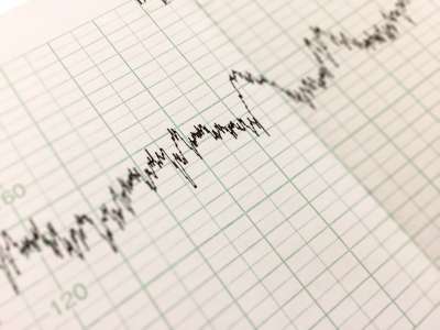 Should You Have Electronic Fetal Monitoring?