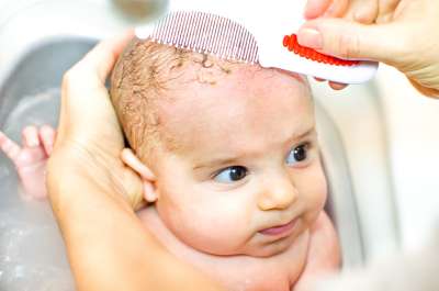 How to Get Rid of Cradle Cap