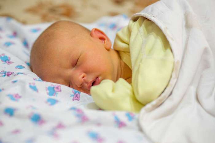 newborn baby with jaundice