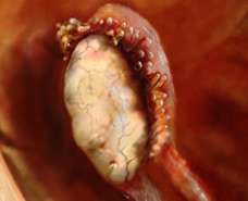 ovary at the end of fallopian tube ready to release egg