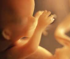 ultrasound of human fetus at 15 weeks exactly