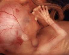 ultrasound of human fetus at 17 weeks exactly