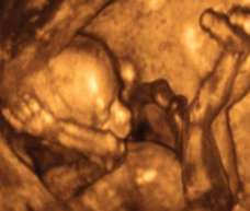 ultrasound of human fetus at 17 weeks and 6 days