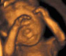 ultrasound of human fetus at 19 weeks exactly