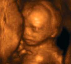 ultrasound of human fetus at 19 weeks and 5 days