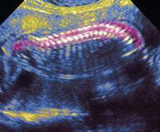 ultrasound of human fetus at 22 weeks exactly