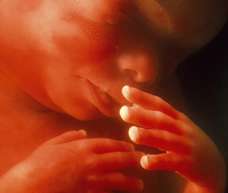 ultrasound of human fetus at 23 weeks exactly