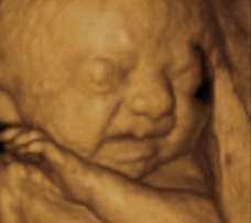 ultrasound of human fetus as 27 weeks exactly