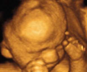 ultrasound of human fetus as 27 weeks and 6 days